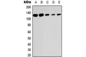 Image no. 2 for anti-SUMO1/sentrin Specific Protease 6 (SENP6) (C-Term) antibody (ABIN2705228)