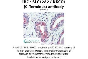 Image no. 1 for anti-Solute Carrier Family 12 (Potassium-Chloride Transporter) Member 2 (SLC12A2) (C-Term) antibody (ABIN1739325)