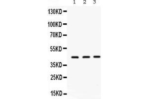 Image no. 2 for anti-Orosomucoid 1 (ORM1) (AA 19-201) antibody (ABIN4886686)