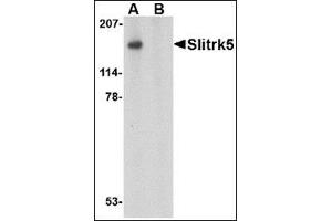 Image no. 2 for anti-SLIT and NTRK-Like Family, Member 5 (SLITRK5) (Center) antibody (ABIN500766)