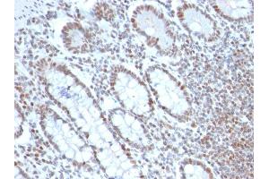 Image no. 3 for anti-BMI1 Polycomb Ring Finger Oncogene (BMI1) (AA 142-326) antibody (ABIN6940581)