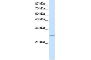 Image no. 1 for anti-MRG-Binding Protein (MRGBP) (Middle Region) antibody (ABIN2777883)