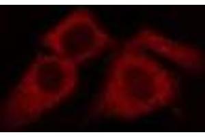 Image no. 1 for anti-Major Histocompatibility Complex, Class I, H (Pseudogene) (HLA-H) antibody (ABIN6258466)