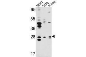 Image no. 1 for anti-E74-Like Factor 5 (Ets Domain Transcription Factor) (ELF5) (Middle Region) antibody (ABIN452951)
