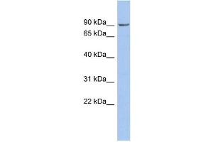 Image no. 1 for anti-Nephronophthisis 1 (Juvenile) (NPHP1) (Middle Region) antibody (ABIN2786505)