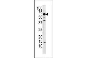 Image no. 1 for anti-Protein Phosphatase 3, Catalytic Subunit, alpha Isoform (PPP3CA) (AA 21-51), (N-Term) antibody (ABIN392891)