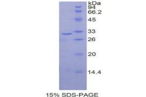 Human V Rel Reticuloendotheliosis Viral Oncogene Homolog B Relb Protein Recombinant Abin