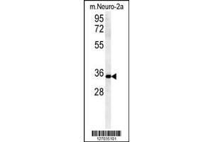 Image no. 1 for anti-Zinc Finger, DHHC-Type Containing 2 (ZDHHC2) antibody (ABIN2494400)