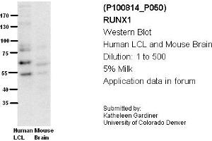 Image no. 3 for anti-Runt-Related Transcription Factor 1 (RUNX1) (Middle Region) antibody (ABIN2792598)