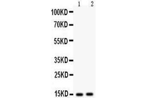 Image no. 2 for anti-Fatty Acid Binding Protein 5 (Psoriasis-Associated) (FABP5) (AA 2-16), (N-Term) antibody (ABIN3043194)