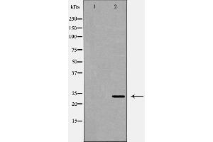 Image no. 1 for anti-Estrogen Receptor Binding Site Associated, Antigen, 9 (EBAG9) (C-Term) antibody (ABIN6261417)