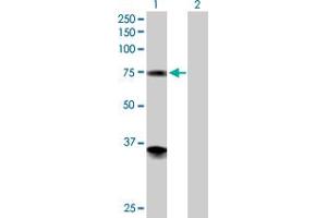 anti-Phosphoglucomutase 2 (PGM2) (AA 1-612) antibody