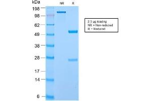 Image no. 1 for anti-Extracellular Matrix Protein 1 (ECM1) antibody (ABIN6939282)