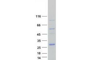 Image no. 1 for Proteasome (Prosome, Macropain) Subunit, beta Type 2 (PSMB2) protein (Myc-DYKDDDDK Tag) (ABIN2729925)
