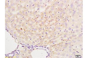 Formalin-fixed and paraffin embedded mouse liver labeled with Anti-APG4B/AUTL1 Polyclonal Antibody, Unconjugated (ABIN685777) at 1:200 followed by conjugation to the secondary antibody and DAB staining.