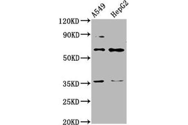 TBX4 Antikörper  (AA 355-511)