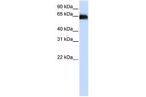 Image no. 1 for anti-ADAM Metallopeptidase Domain 12 (ADAM12) (N-Term) antibody (ABIN2776751)