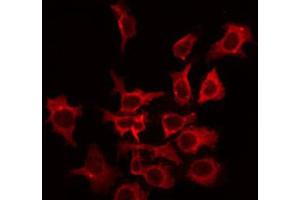 Image no. 3 for anti-Potassium Voltage-Gated Channel, Shaw-Related Subfamily, Member 2 (KCNC2) (C-Term) antibody (ABIN6262739)