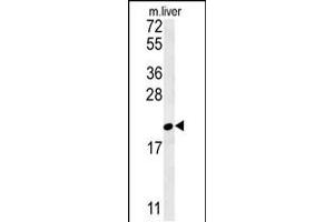 Image no. 2 for anti-GM2 Ganglioside Activator (GM2A) (AA 25-54), (N-Term) antibody (ABIN5536648)