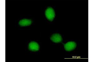 Immunofluorescence of purified MaxPab antibody to FRMD8 on HeLa cell.