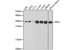 Image no. 6 for anti-Replication Protein A2, 32kDa (RPA2) antibody (ABIN3023166)