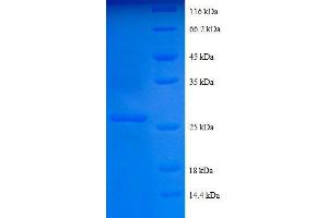 SDS-PAGE (SDS) image for Collagen, Type IV, alpha 2 (COL4A2) (AA 1493-1712), (partial) protein (His tag) (ABIN1046842)