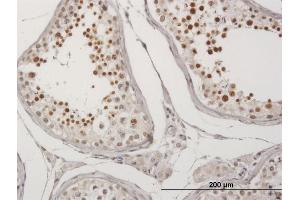 Image no. 3 for anti-MRG-Binding Protein (MRGBP) (AA 1-204) antibody (ABIN949439)