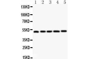 Image no. 2 for anti-Nuclear Receptor Subfamily 1, Group H, Member 3 (NR1H3) (AA 375-398), (C-Term) antibody (ABIN3043617)