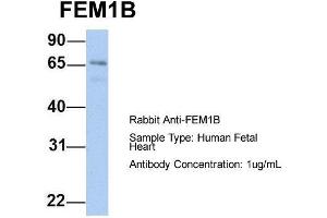 Image no. 1 for anti-Fem-1 Homolog B (FEM1B) (C-Term) antibody (ABIN2774057)