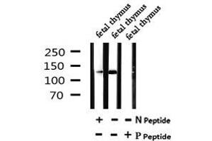 Image no. 2 for anti-Splicing Factor 3b, Subunit 1, 155kDa (SF3B1) (pThr211) antibody (ABIN6269723)