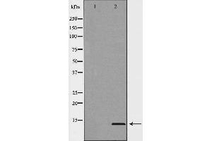 Image no. 1 for anti-Microseminoprotein, beta (MSMB) (Internal Region) antibody (ABIN6263398)
