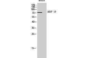 Image no. 1 for anti-A Kinase (PRKA) Anchor Protein 10 (AKAP10) (N-Term) antibody (ABIN3183216)