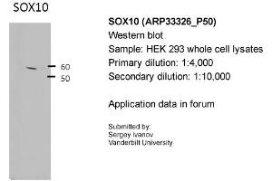 Image no. 4 for anti-SRY (Sex Determining Region Y)-Box 10 (SOX10) (Middle Region) antibody (ABIN2777864)