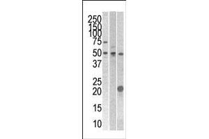 Image no. 1 for anti-serine/threonine/tyrosine Kinase 1 (STYK1) (AA 31-64), (N-Term) antibody (ABIN392121)
