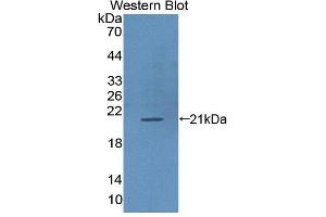 Image no. 3 for anti-Intercellular Adhesion Molecule 3 (ICAM3) (AA 46-197) antibody (ABIN5013759)