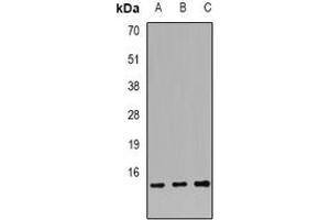 Image no. 1 for anti-S100 Calcium Binding Protein A12 (S100A12) (full length) antibody (ABIN6006064)