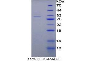 Image no. 1 for Nucleoporin 88kDa (NUP88) (AA 57-296) protein (His tag) (ABIN1878915)