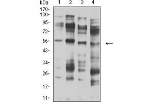 Image no. 5 for anti-Cholinergic Receptor, Nicotinic, alpha 5 (Neuronal) (CHRNA5) (AA 23-254) antibody (ABIN5611355)