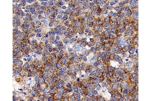 Immunohistochemistry analysis of paraffin-embedded human tonsil using CD192 Polyclonal Antibody at dilution of 1:300.