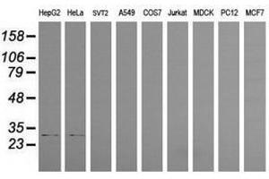 Image no. 2 for anti-Proteasome (Prosome, Macropain) Inhibitor Subunit 1 (PI31) (PSMF1) antibody (ABIN1500490)