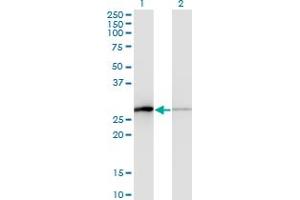 TCEAL1 Antikörper  (AA 1-159)
