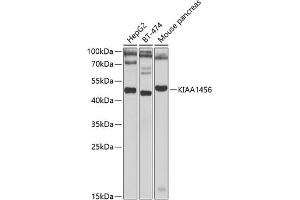 KIAA1456 anticorps  (AA 110-330)