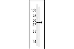 Image no. 1 for anti-Moloney Sarcoma Oncogene (MOS) (AA 1-30), (N-Term) antibody (ABIN392644)