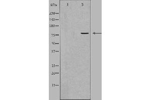 Image no. 2 for anti-Adrenergic, Beta, Receptor Kinase 2 (ADRBK2) antibody (ABIN6256967)