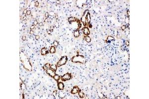 Image no. 1 for anti-Solute Carrier Family 2 (Facilitated Glucose/fructose Transporter), Member 5 (SLC2A5) (AA 232-251), (Middle Region) antibody (ABIN3044131)