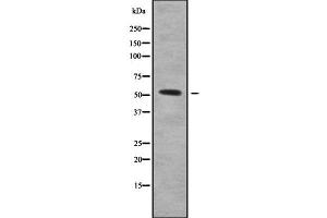 Image no. 1 for anti-serpin Peptidase Inhibitor, Clade A (Alpha-1 Antiproteinase, Antitrypsin), Member 10 (SERPINA10) antibody (ABIN6265002)