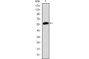 Image no. 5 for anti-Junction Plakoglobin (JUP) antibody (ABIN969225)