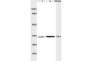 Image no. 2 for anti-CD1d1 (CD1D1) (AA 51-150) antibody (ABIN702700)