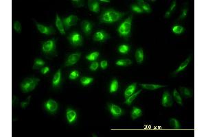 Immunofluorescence of monoclonal antibody to COG7 on HeLa cell.