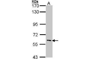 Image no. 2 for anti-Interleukin-1 Receptor-Associated Kinase 3 (IRAK3) (Center) antibody (ABIN2855791)